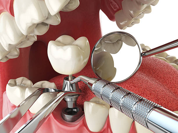 Best Cracked Tooth Emergency Dentist  in Buena, NJ